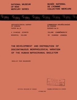 Development and Distribution of Discontinuous Morphological Variation of the Human Infracranial Skeleton