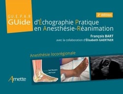 Guide d'Échographie Pratique en Anesthésie-Réanimation - GUEPAR (2e édition) - Anesthésie locorégionale