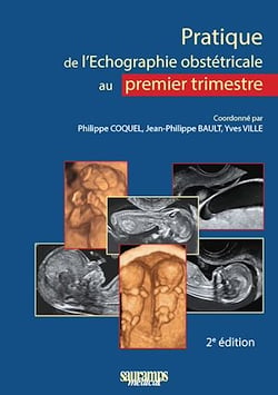 Pratique de l'échographie obstétricale au premier trimestre