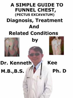 A  Simple  Guide  to  Funnel Chest (Pectus Excavatum),  Diagnosis, Treatment  and  Related Conditions