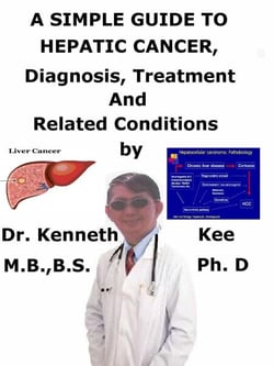 A  Simple  Guide  to  Hepatic Cancer,  Diagnosis, Treatment  and  Related Conditions