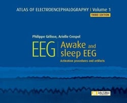 Atlas of electroencephalography - Volume 1 : Awake and sleep EEG. 3ED - Activation procedures and artifacts.