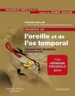 Imagerie de l'oreille et de l'os temporal - Volume 3. Traumatologie, urgences, otospongiose