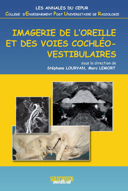 Imagerie de l'oreille et des voies cochléovestibulaires