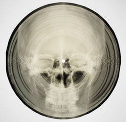 Bone Music - Soviet X-Ray Audio