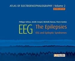 Atlas of electroencephalography Volume 2 : The Epilepsies. 2ED - EEG and epileptic syndromes