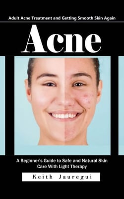 Acne: Adult Acne Treatment and Getting Smooth Skin Again (A Beginner’s Guide to Safe and Natural Skin Care With Light Therapy)