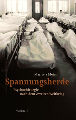 Spannungsherde - Psychochirurgie nach dem Zweiten Weltkrieg