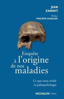 Enquête à l'origine de nos maladies - Ce que nous révèle la paléopathologie