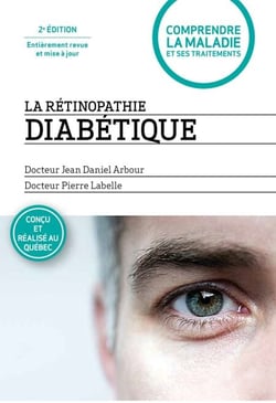 La rétinopathie diabétique - 2e édition entièrement revue et mise à jour - 2e édition entièrement revue et mise à jour
