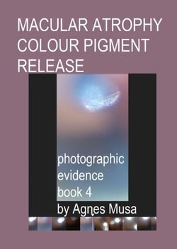 Macular Atrophy Colour Pigment Release, Photographic Evidence Book 4 - Macular Degeneration Atrophy, Photographic Evidence Series of   Books, #15