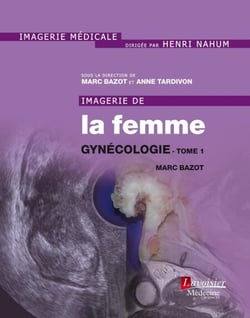Imagerie de la femme : Gynécologie - Tome 1