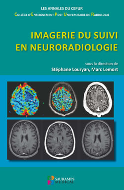 Imagerie du suivi en neuroradiologie