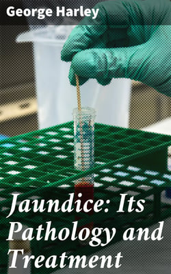 Jaundice: Its Pathology and Treatment - With the Application of Physiological Chemistry to the Detection and Treatment of Diseases of the Liver and Pancreas