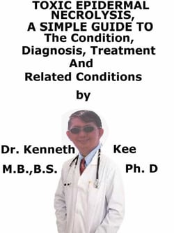 Toxic Epidermal Necrolysis,  A  Simple  Guide  To  The Condition, Diagnosis, Treatment  And  Related Conditions