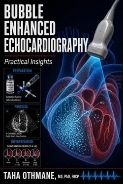 Bubble Enhanced Echocardiography: Practical Insights - Medical Series