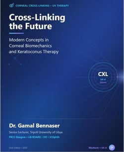 Corneal Cross Linking the Future for Corneal Biomechanics