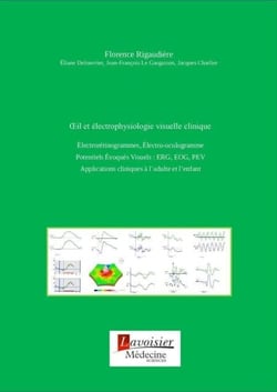OEil et électrophysiologie visuelle clinique - Électrorétinogrammes, Électro-oculogramme. Potentiels Évoqués Visuels : ERG, EOG, PEV....