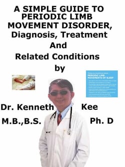 A  Simple  Guide  to  Periodic Limb Movement Disorder,  Diagnosis, Treatment  and  Related Conditions
