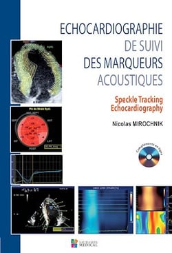 Echocardiographie de suivi des marqueurs acoustiques
