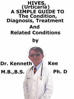 Hives, (Urticaria)  A  Simple  Guide  To  The Condition, Diagnosis, Treatment  And  Related Conditions