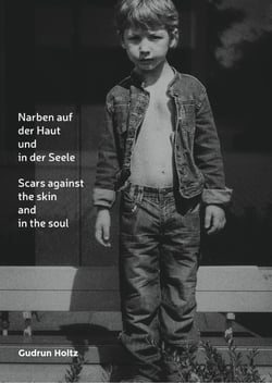 Narben auf der Haut und in der Seele - Scars against the skin and the soul