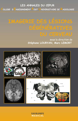 Imagerie des lésions dégénératives du cerveau