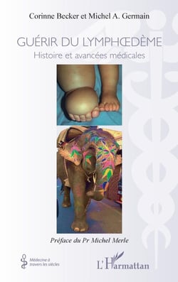Guérir du lymphoedème - Histoires et avancées médicales