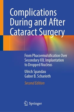 Complications During and After Cataract Surgery - From Phacoemulsification Over Secondary IOL Implantation to Dropped Nucleus