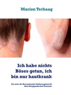 Ich habe nichts Böses getan, ich bin nur hautkrank - Ein unter die Haut gehender Erfahrungsbericht über Schuppenflechte/Psoriasis