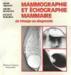 Mammographie et échographie mammaire - de l'image au diagnostic
