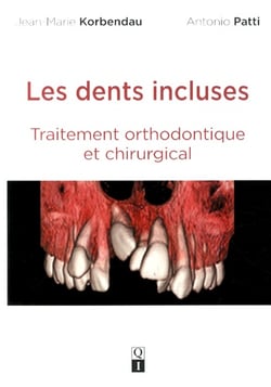 Les dents incluses - traitement orthodontique et chirurgical