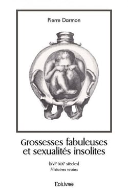 Grossesses fabuleuses et sexualites insolites (xvie xixe siecles) - histoires vraies
