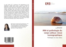 IRM et pathologie du corps calleux: revue iconographique : Suivie et evaluation du traitement en vue d'une amelioration