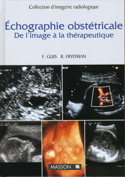 Echographie ostetricale