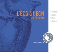 L'ecg à l'ecn en 75 tracés