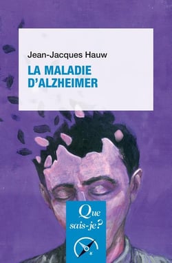 La maladie d'Alzheimer