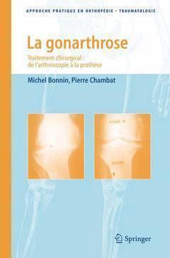 La gonarthrose - traitement chirurgical : de l'arthroscopie à la prothèse