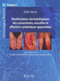 Manifestations dermatologiques de collectivites, vasculites et affections systémiques apparentées