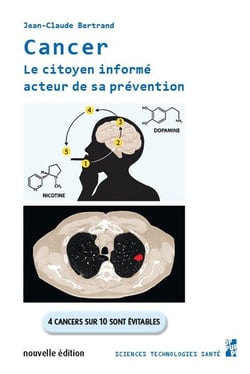 Cancer : Le citoyen informé acteur de sa prévention - 4 cancers sur 10 sont évitables