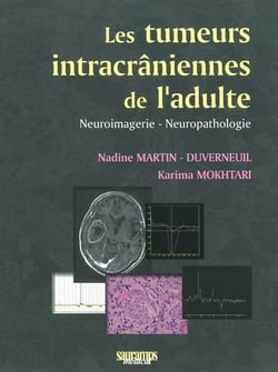 Les tumeurs intracrâniennes de l'adulte - neuroimagerie, neuropathologie