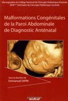 Malformations congénitales de la paroi abdominale de diagnostic anténatal