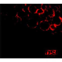 Blood - édition limitée