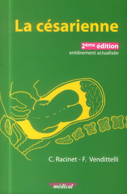 La césarienne
