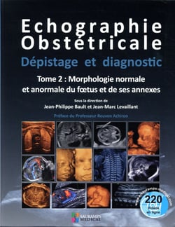Échographie obstétricale - dépistage et diagnostic Tome 2 - morphologie normale & anormale du foetus et de ses annexes