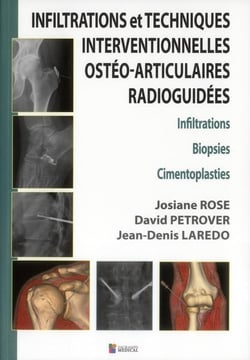Infiltrations et techniques interventionnelles osteo-articulaires radioguidees