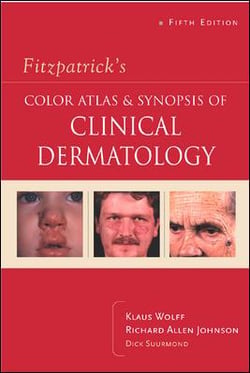 Fitzpatrick's color atlas and synopsis of clinical dermatology - 5th rev ed