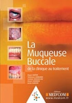 La muqueuse buccale - de la clinique au traitement
