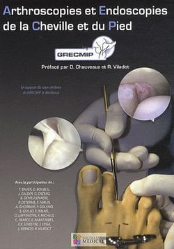 Arthroscopies et endoscopies de la cheville et du pied