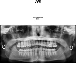 JVC
